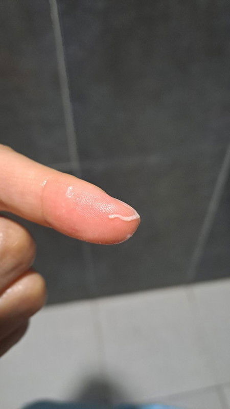 May Discharge na lumalabas. Buntis o Hindi?