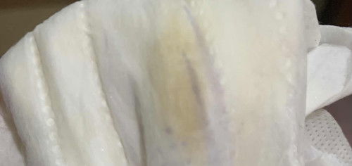 Dark spot 36w. Adakah tanya nk bersalin?