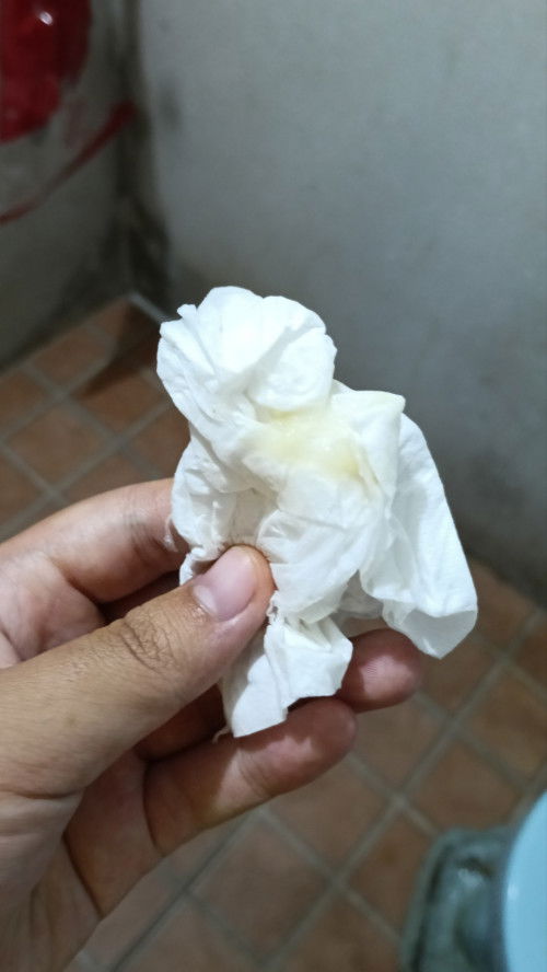 36+5 มีมูกไหลออกมาค่ะ เเบบนี้ต้องไปหาหมอมั้ยคะ
