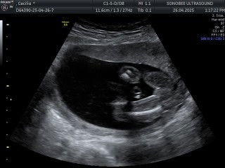 Boy Or girl ?