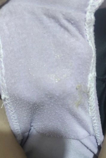 Pasintabi po, kapag po ba ganyan na nalabas po, nakabukas na po ba cervix?