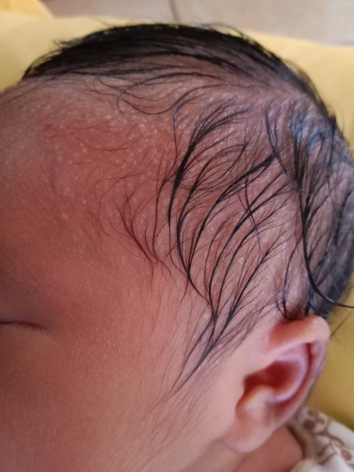 baby 10 hari