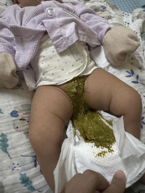 Tahi bayi hijau