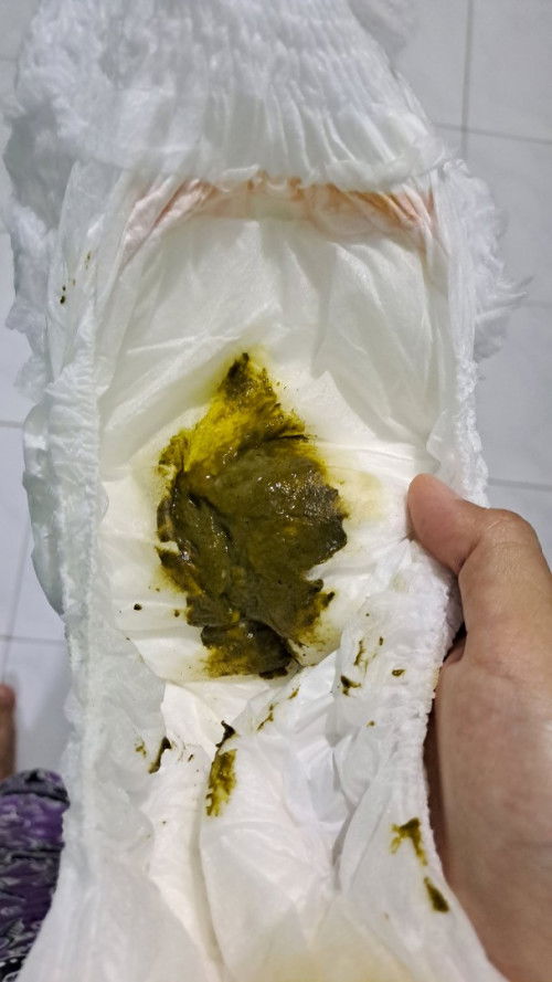 Bun ini diare ga ya?