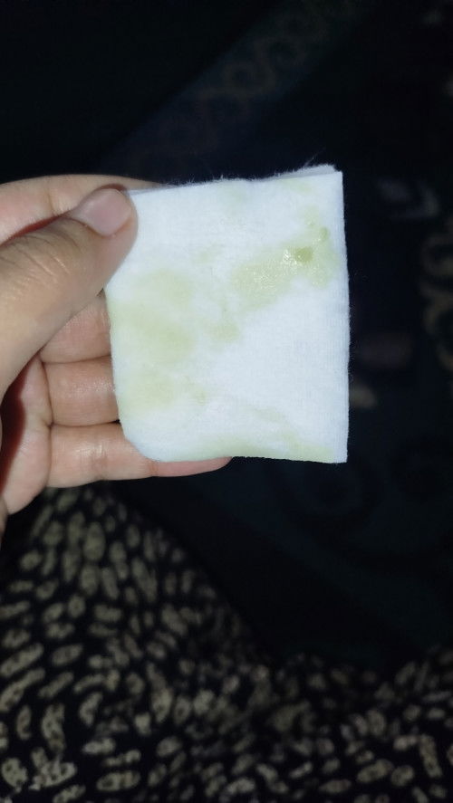 Keluar cairan kuning
