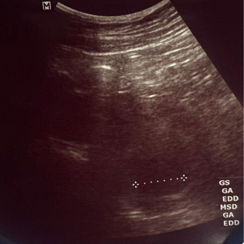 8weeks ไม่เจอตัวน้อง