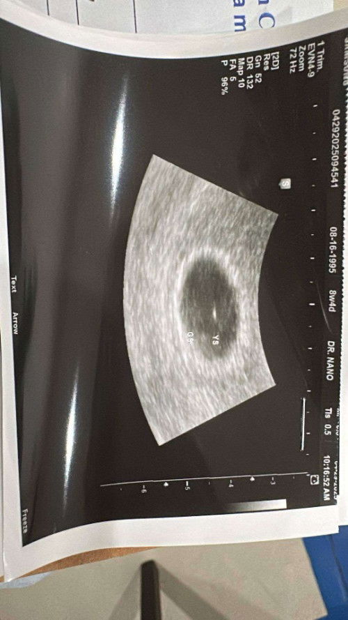 8weeks

wala dw pong makitang baby sa bahay bata, positive sa PT never nagbleeding.

ano po kaya un?
