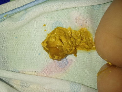 Pup bayi berlendir