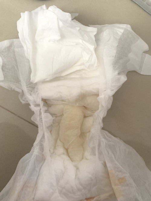 warna pipis bayi 1 bulan setengah