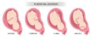 Uri/placenta