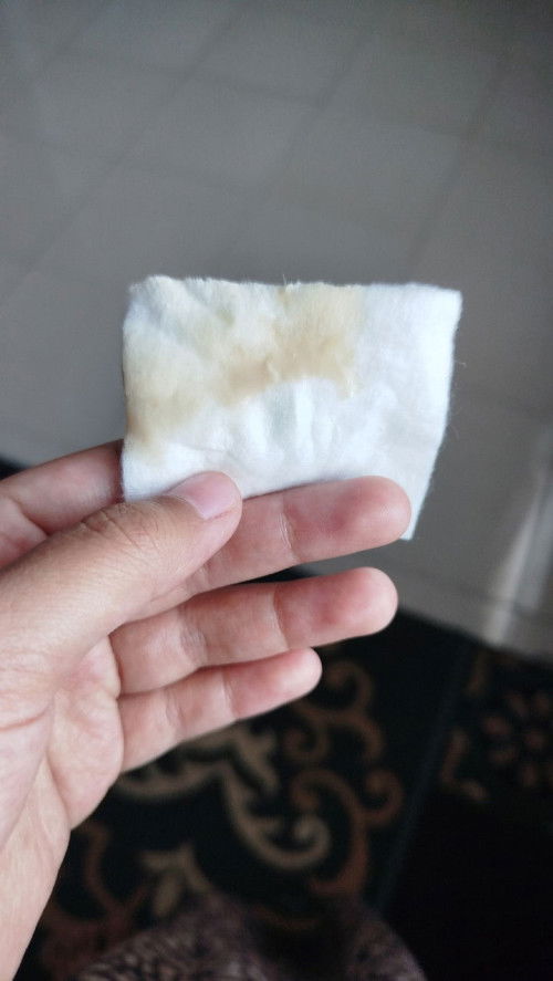 Keluar cairan coklat