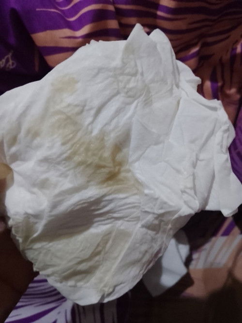 Keluar cairan setelah berhubungan?
