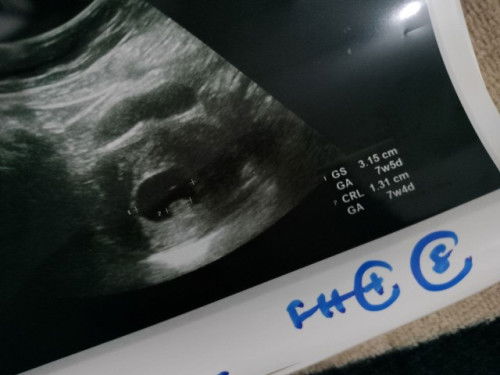 Nampak macam second yolk belah kanan tu