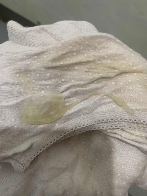Mucus plug naba to?