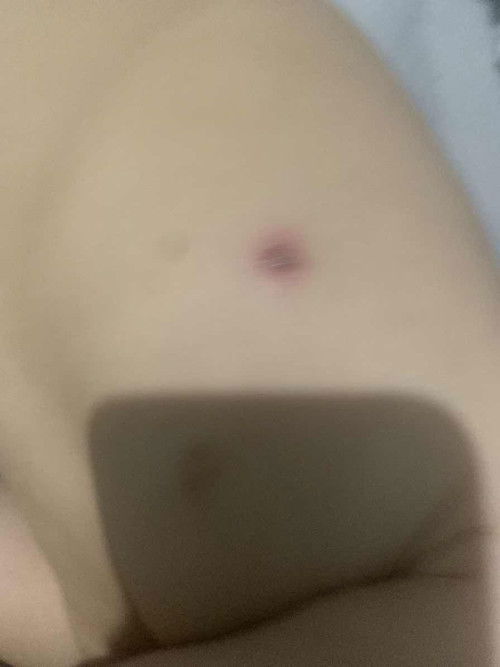 Kubis tanpa sebab