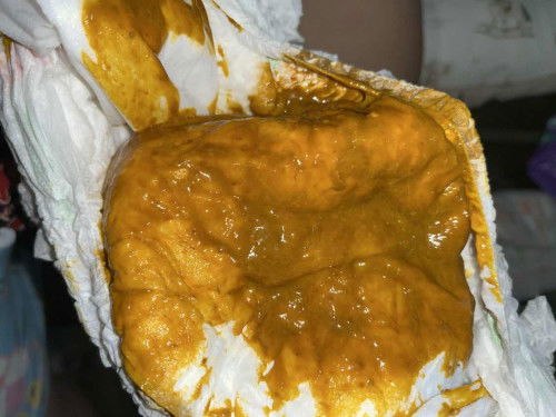 สอบถามแม่ๆค่าา