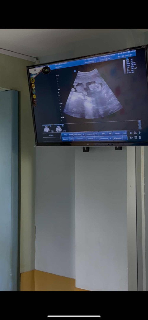 ขอสอบถามเรื่องเพศคะ