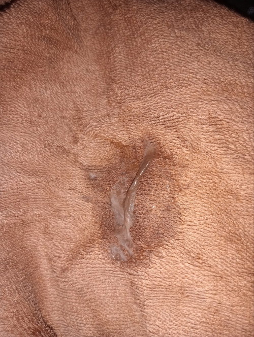 สีมูกแบบนี้ปกติมั้ยค่ะ ?