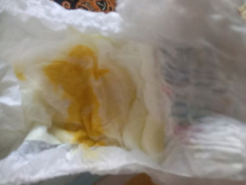 Pup bayi 4 bulan sudah 3 hari seperti ini sambil kentut sehari bisa 2/3x. Biasanya pulen
