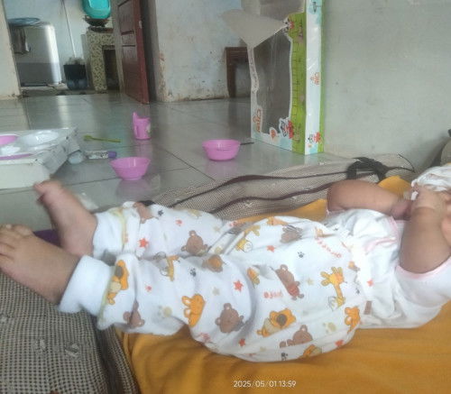 Bayi menegangkan kaki