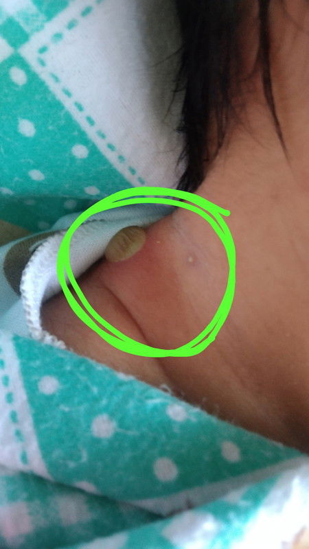 Bayi seminggu