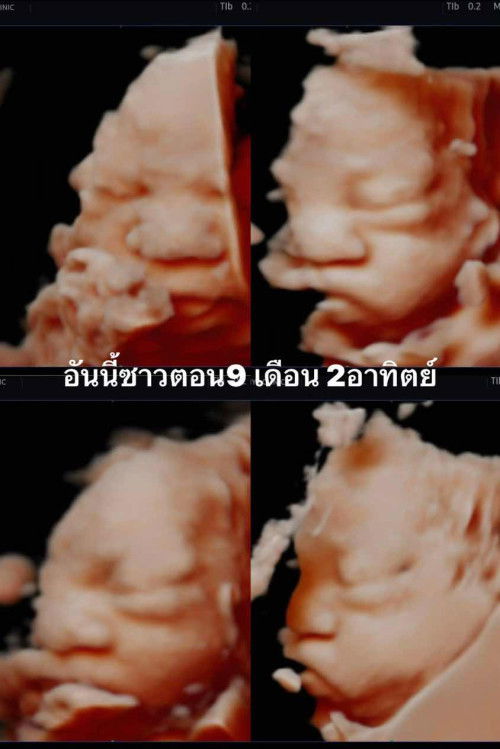 ทำไมมันถึงเปลี่ยนไปได้ขนาดนี้ค่ะ5555