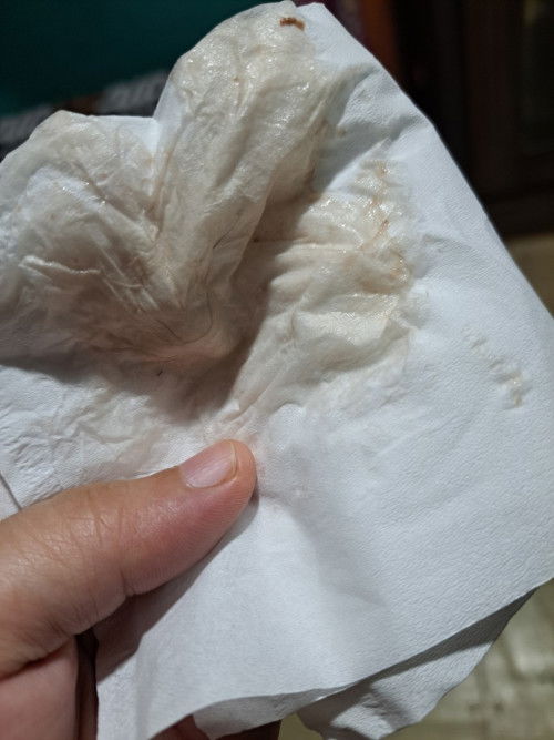 Apakah ini tanda2 persalinan moms?