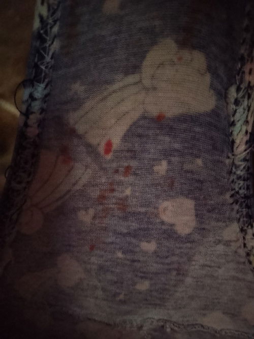 21 weeks with light spotting normal po ba?