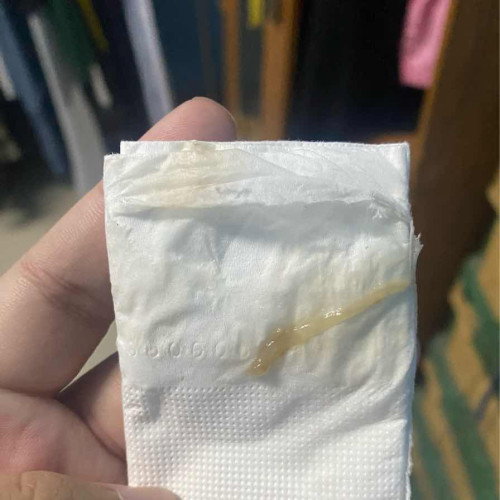 39 + 3 วีค โดนกระตุ้นคลอด