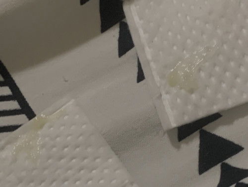 mga mommies ask lang po, mucus plug pu ba to? parang sipon texture nya // currently 37 weeks 1cm