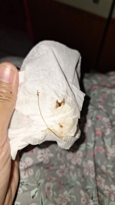 Flek 16 minggu