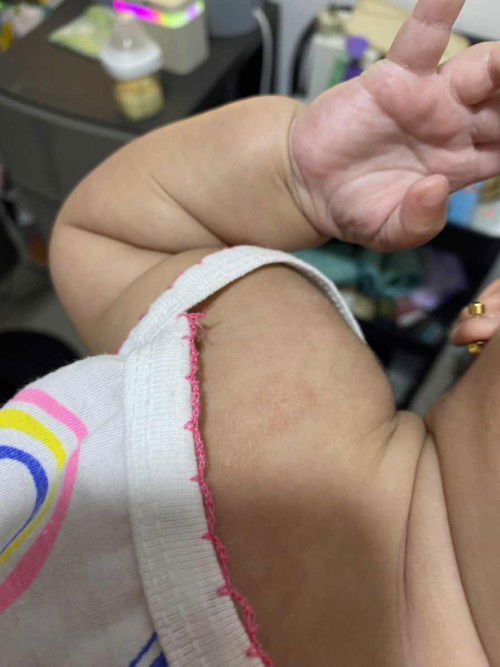 ANO KLASD SKIN PROBLEM KAYA ITO?