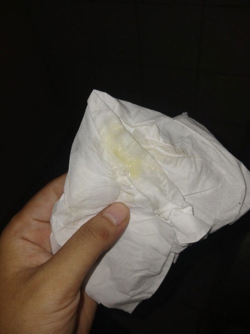 Bun mau tanya hamil 30 week sering keluar kaya gini ,ini keputihan atau air ketuban ya