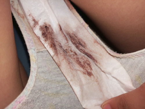 Pasintabi Po sa lahat ng kumakain 
Salamat Po sa makakasagot
Panty liner Po pala gamit ko