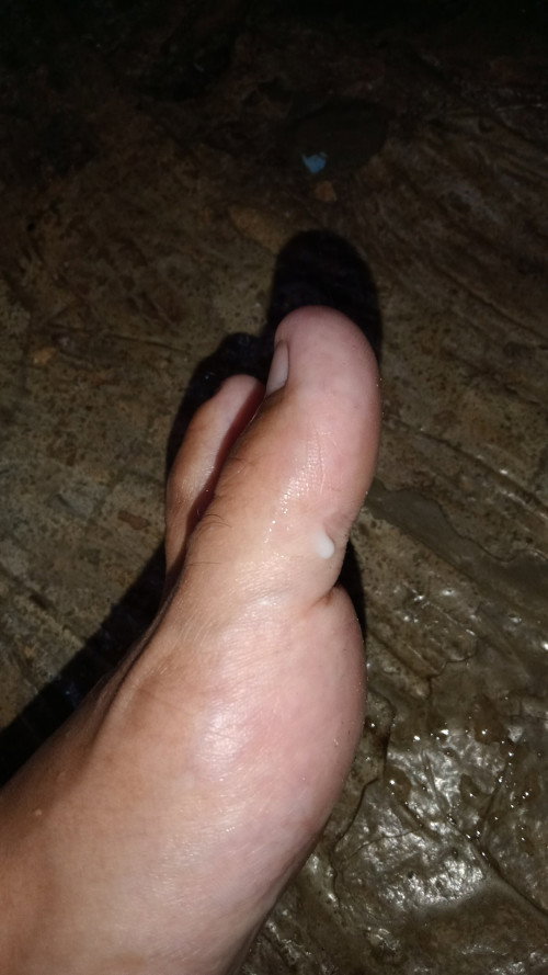 Ketuban atau keputihan