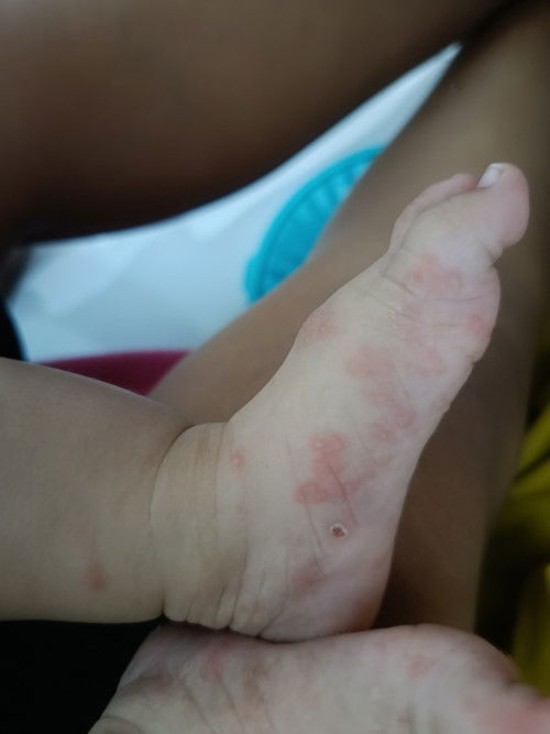 Ada yg tau gk ini pake apa , udh d bwa ke dokter gk ada perubahan