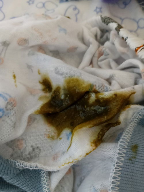 Pup anak seperti ini s