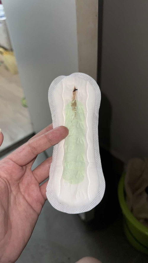 Is this normal?