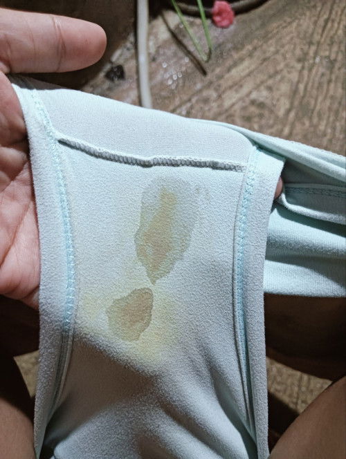 ผ่าคลอดได้1เดือน6วัน