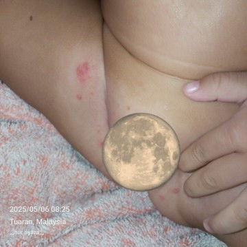 Anak masuk 11 bulan
