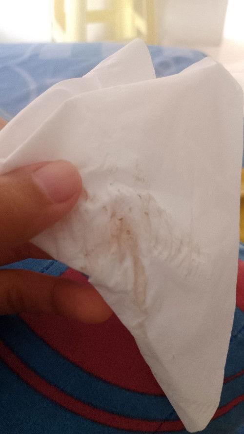USG pertama usia 4minggu baru ada kantong nya saja
