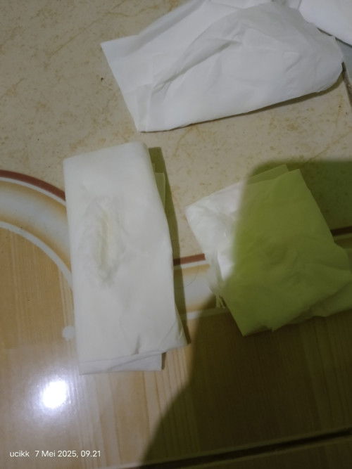 Ini keputihan atau apa ya bund bantu jawab