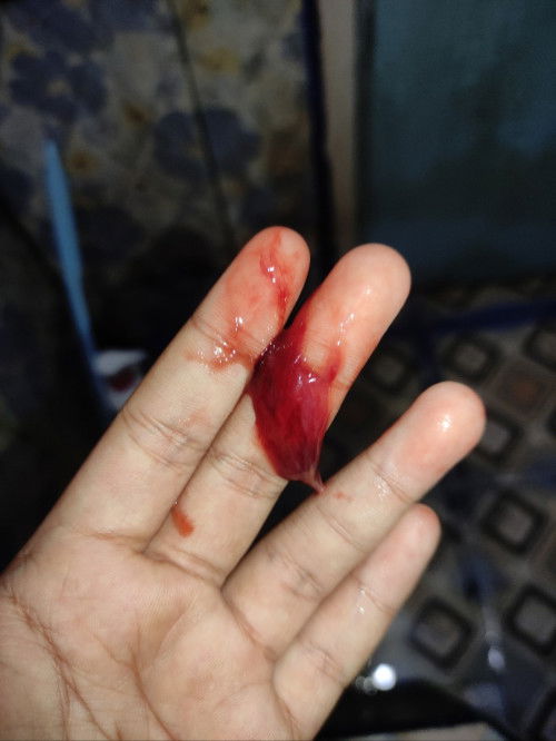MUNCUL LENDIR DARAH
