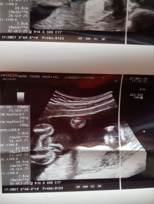 ช่วยดูหน่อยค่ะแม่ๆ