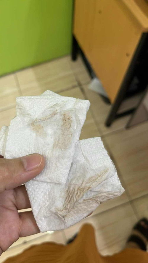 Discharge at 25 weeks