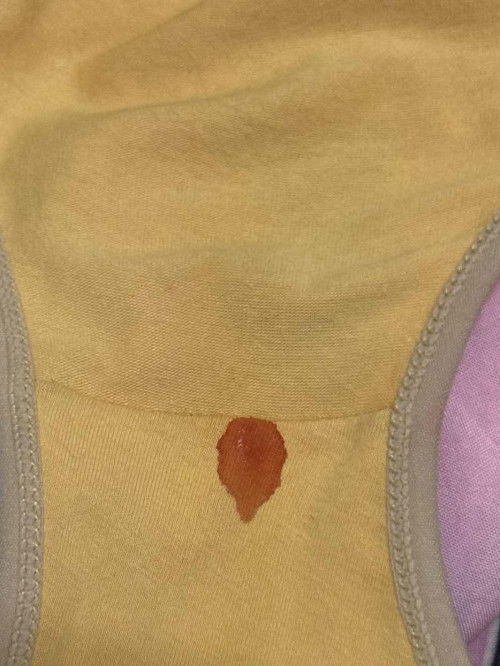 Spotting period ke pregnant?