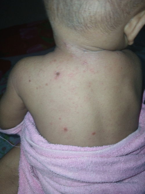 Bintik2 d bagian tubuh