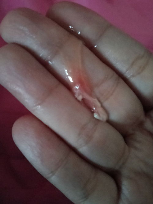 18w 5d keluar lendir macam ni