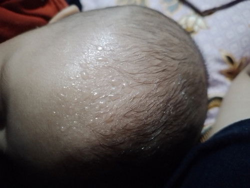 Keringetan saat menyusu