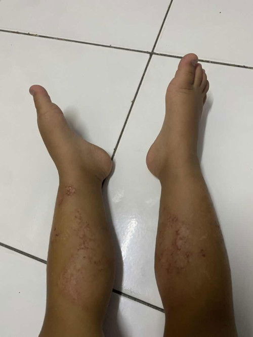 Tak tahu nak pakai ubat apa lagi